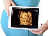 3D-скрининг при беременности - серьёзная диагностика или фото малыша на память?